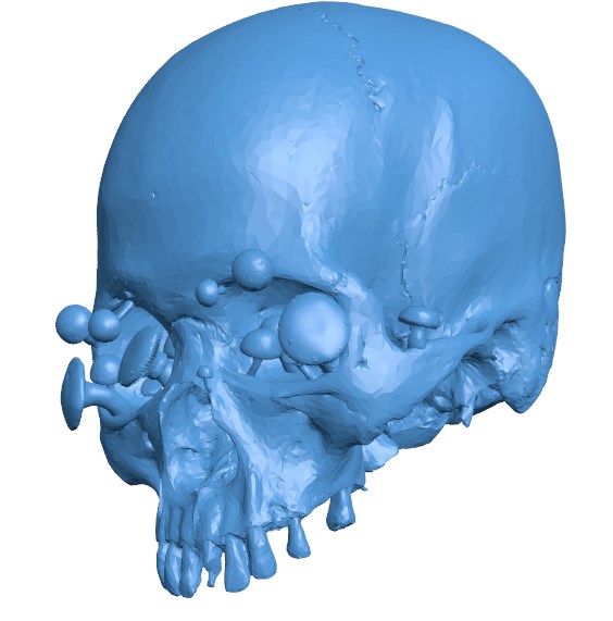 Mushroom Skull Head B004141 file stl free download 3D Model for CNC and 3d printer