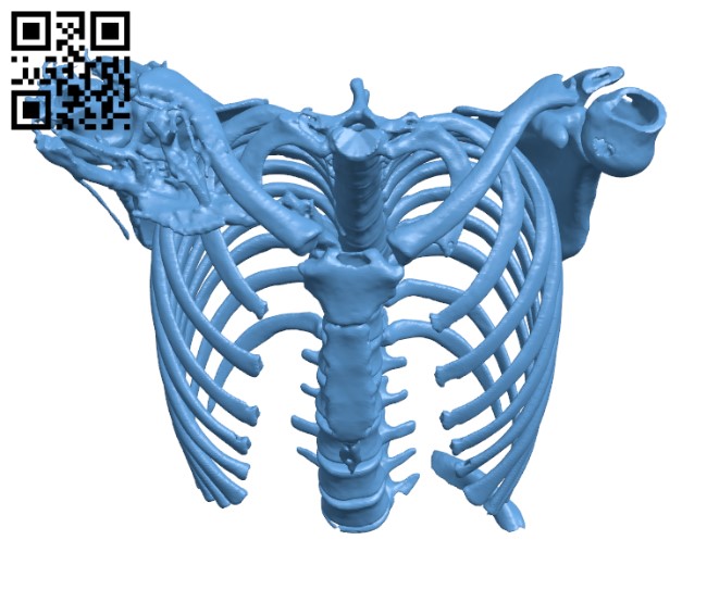 Spine with a T10 chance fracture H000650 file stl free download 3D Model for CNC and 3d printer